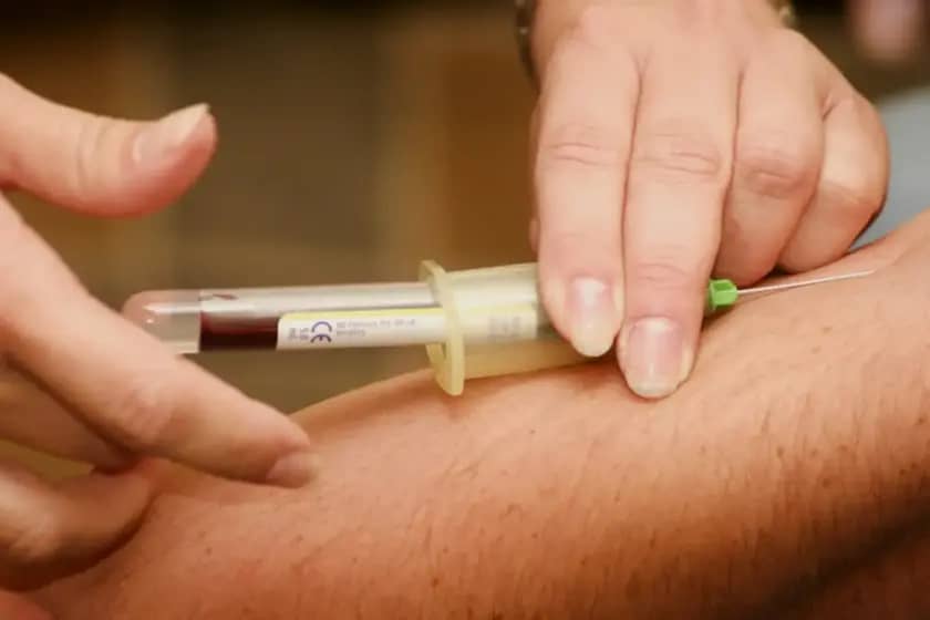 Visok LDL holesterol: Kako ga kontrolisati i sprečiti srčane bolesti?