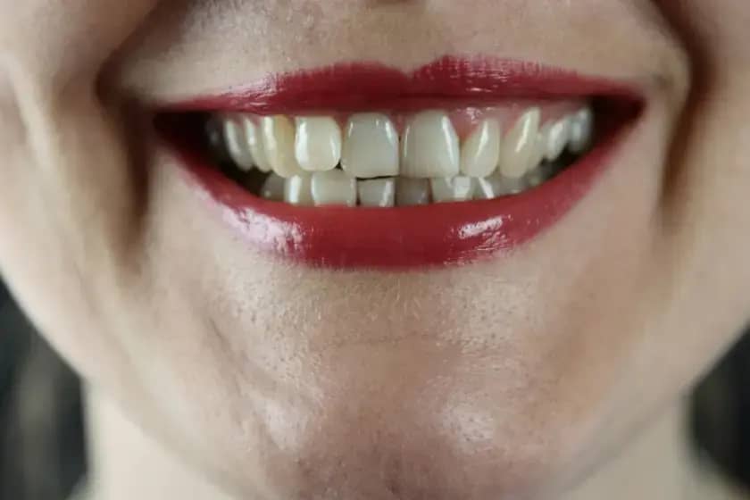 Rak usne duplje: Simptomi, uzroci i prevencija koju morate znati!