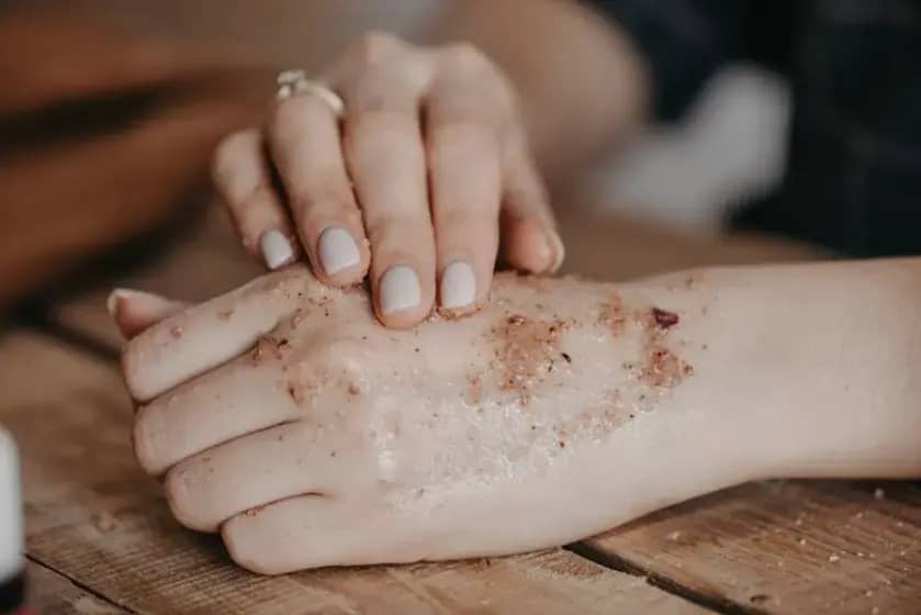 Seboroični dermatitis: Najčešći simptomi, uzroci i efikasni tretmani protiv peruti i svraba