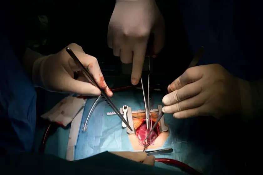 Memorandum u RS pokreće revoluciju u transplantaciji i donorstvu: Fondacija Kaća, HLA tipizacija i psihološka podrška