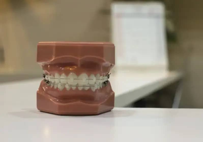 Kako prepoznati zdrave i nezdrave desni: simptomi gingivitisa, parodontitisa i najbolja prevencija