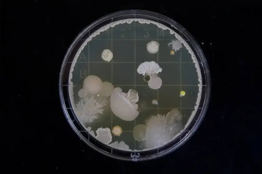Leptospiroza: Simptomi, prevencija i hitne mere - Sve što trebate znati kako biste se zaštitili
