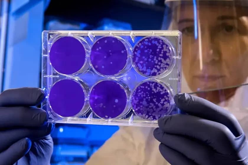 Zemcelpro: Revolucionarna Terapija za Transplantaciju Matičnih Ćelija i Borbu protiv Mijeloma