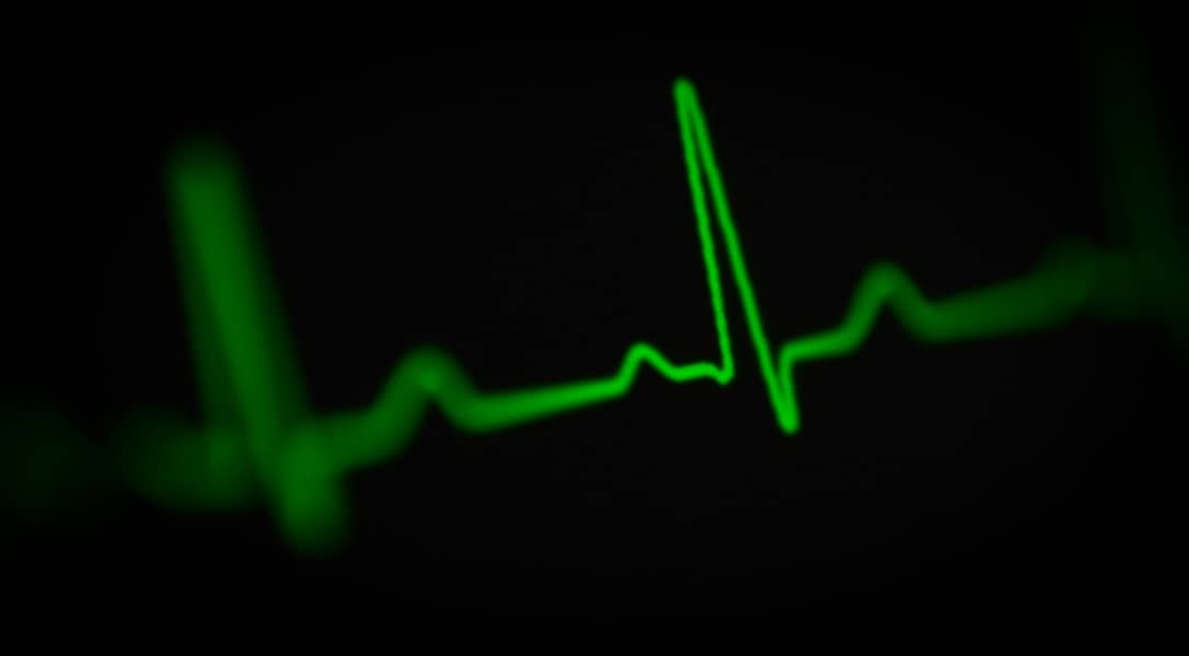 12 Prirodnih i Efikasnih Načina za Brzo Smanjenje Pogona Srca i Stres