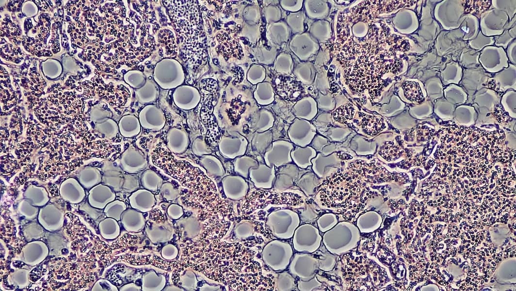 MCAS sindrom: Simptomi, dijagnoza i ključni faktori prepoznavanja mastocitne aktivacijske bolesti