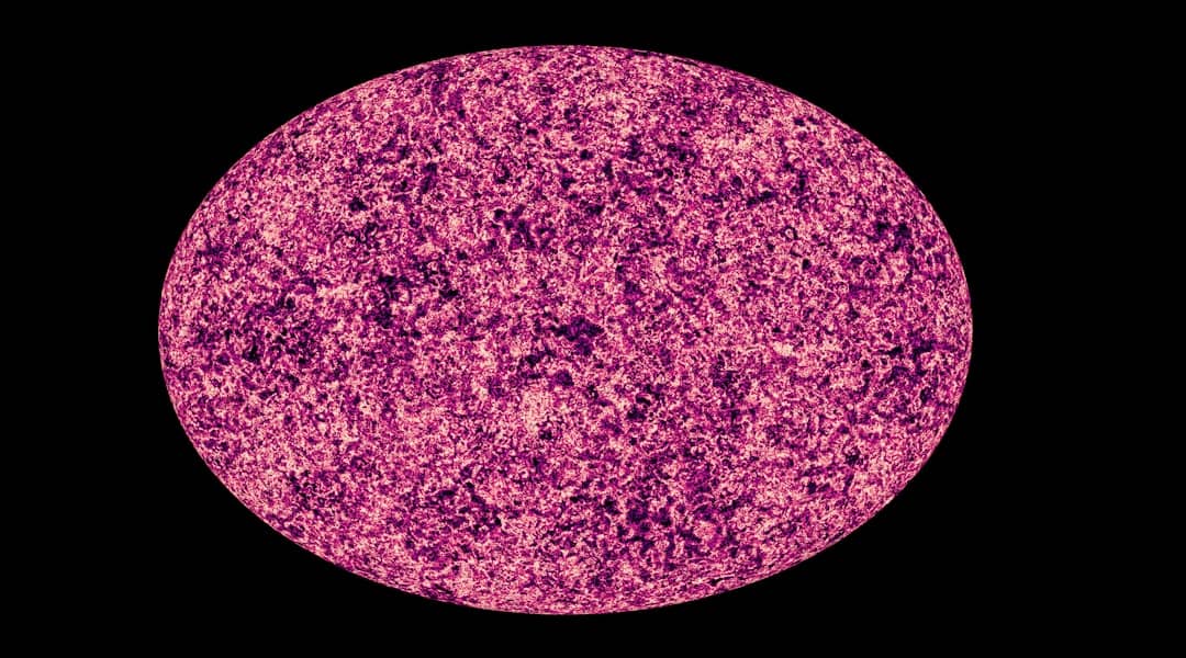 Limfom: Neobični simptomi koje morate znati — noćno znojenje, gubitak težine i uvećani limfni čvorovi