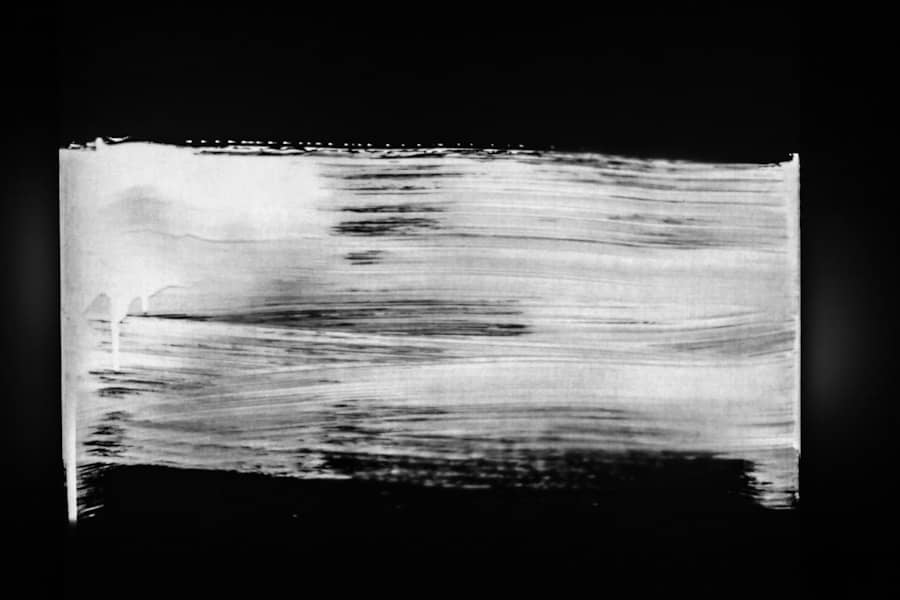 Zašto je moždani udar češći kod mlađih osoba? Simptomi, terapijski prozor i nove metode lečenja na VMA