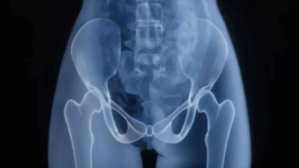 Užički urologi oborili rekord: uspešna operacija ekstremno uvećane prostate i uklanjanje benignog tumora