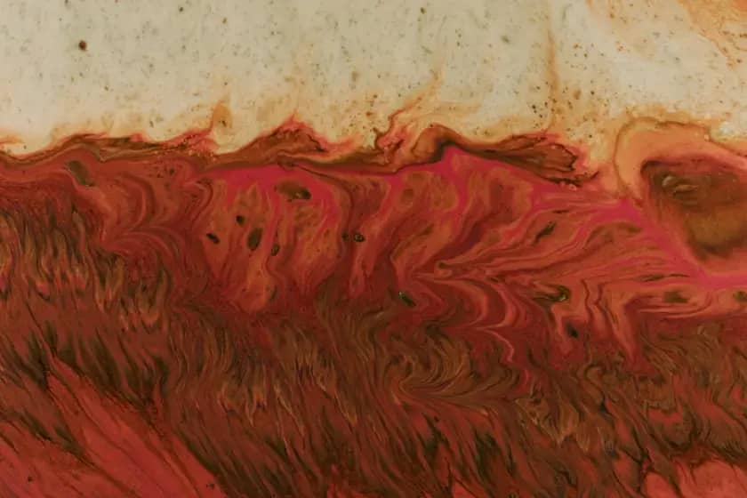 Sindrom kapilarnog curenja: Simptomi, uzroci i hitne mjere za nizak krvni pritisak i edem