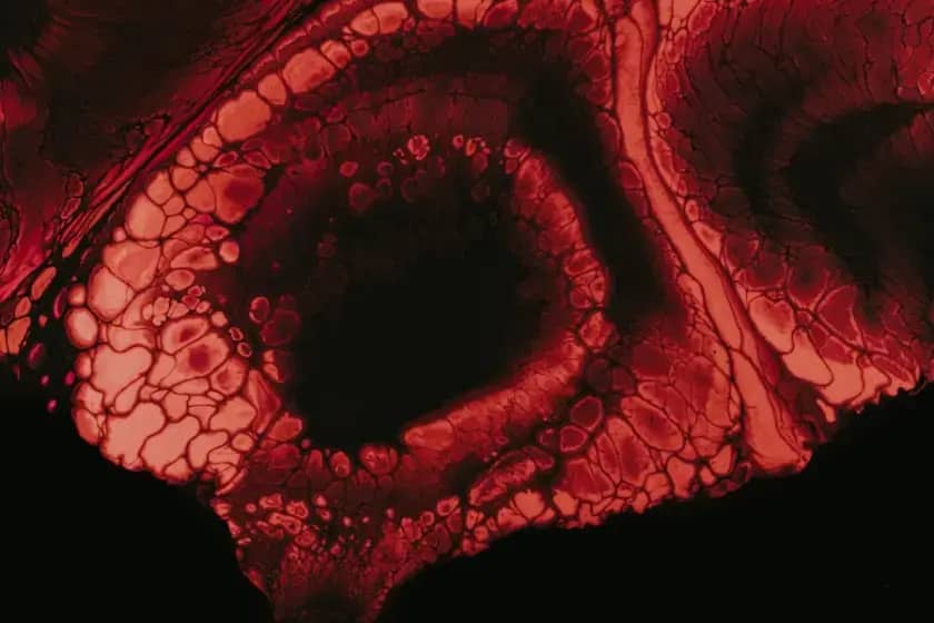 Portalna vena otkrivena: Simptomi portalne hipertenzije, tromboza i kako sačuvati zdravlje jetre