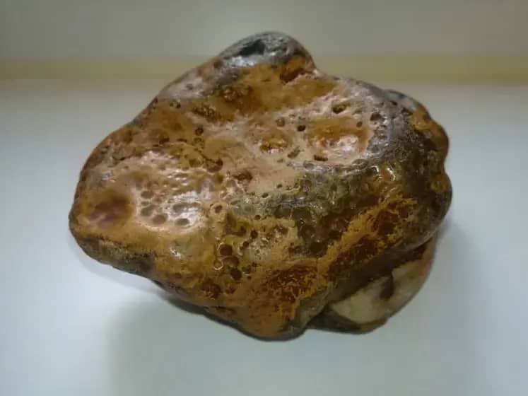 Kamen u bešici ili kamen u bubregu: Kako prepoznati simptome, uzroke i najbolje metode lečenja