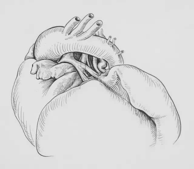 Snaga stiska u 50. godini otkriva vaše zdravlje u 70-ima: kako poboljšati stisak i produžiti život