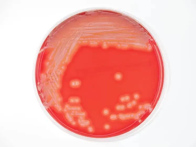 Stafilokokne infekcije: Simptomi, MRSA rizik i najbolje metode lečenja antibioticima