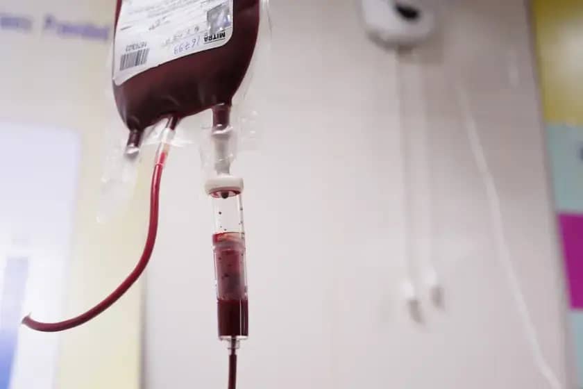 Skandal transfuzije krvi: Deca zaražena HIV-om i talasemijom, sumnja na banku krvi bez NAT testova