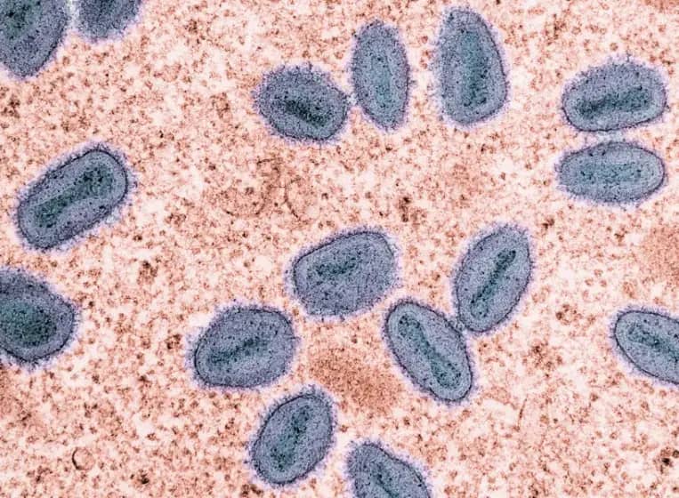 ECDC upozorava: Novi mpox slučajevi u Evropi — Kako prepoznati majmunske boginje, simptomi i prenos