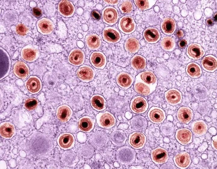 Opasni citomegalovirus u trudnoći: Kako kongenitalni CMV ugrožava bebu i šta trudnice moraju znati