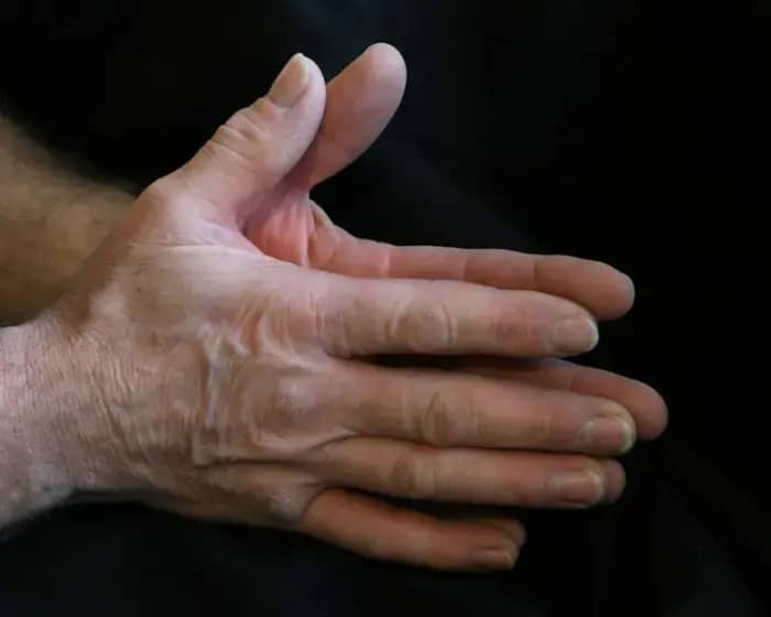 Snaga stiska šake predskazuje prekliničku gojaznost i rizik od smrtnosti: nova studija otkriva ključne pragove