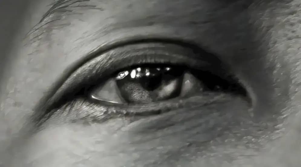 Iritis (uveitis): Simptomi, uzroci i lečenje koje sprečava komplikacije i gubitak vida