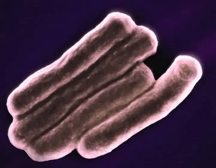 Helicobacter pylori: Simptomi, dijagnoza i efikasno lečenje koje smanjuje rizik od raka želuca