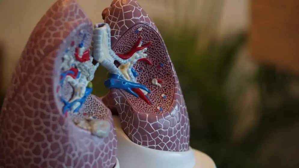 Rak pluća: Epidemija koja preti ljudima, sa simptomima koje često ne prepoznajemo!