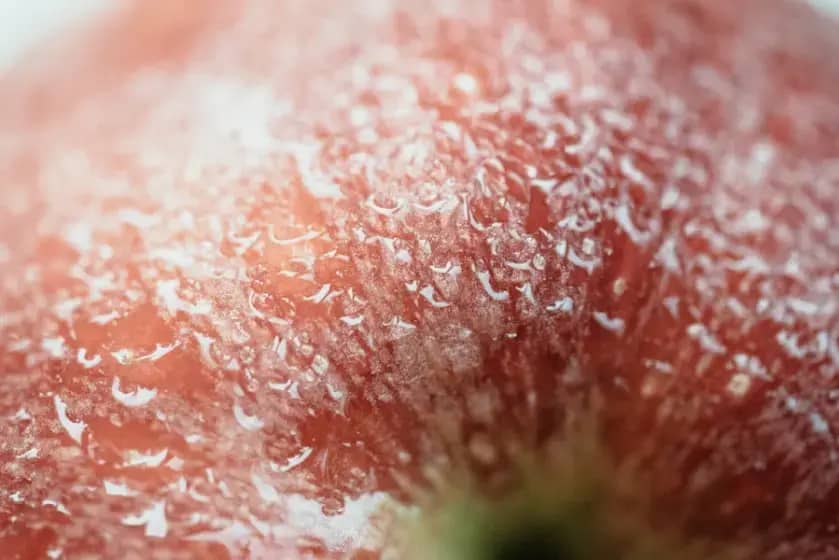 Tinea versikolor: Simptomi, uzroci, dijagnoza i najbolji načini liječenja i prevencije