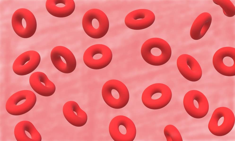 Srpasta anemija i njene ozbiljne komplikacije: Akutni torakalni sindrom
