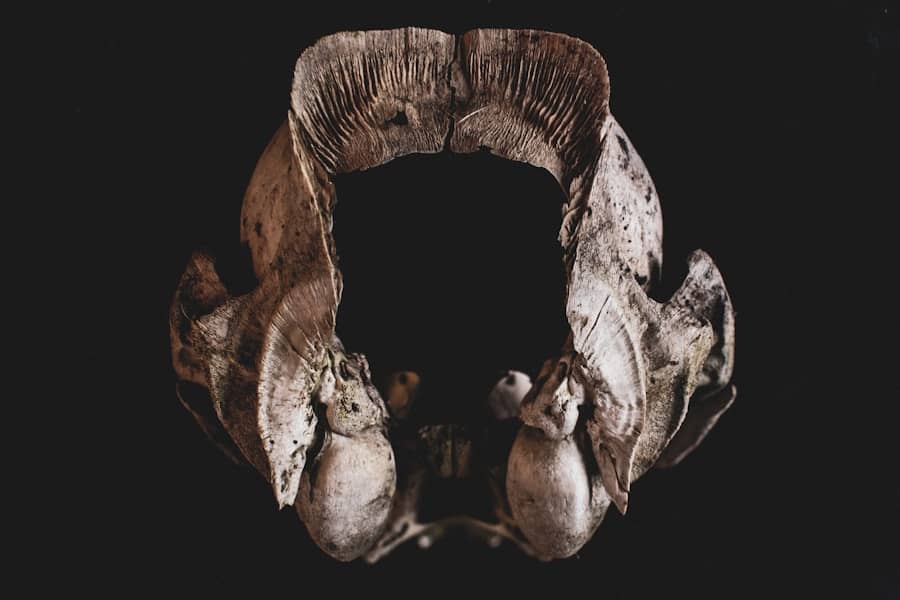 Epiglotitis koji ubija: Kako zatvaranje grla i hipoksični srčani zastoj u Bostonu završili smrću i simptomi epiglotitisa koje treba znati