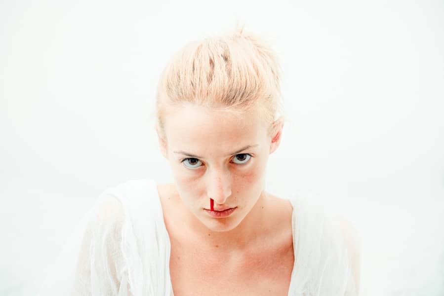 Krvarenje iz nosa noću: najčešći uzroci, kako zaustaviti epistaksu i kada hitno kod ljekara