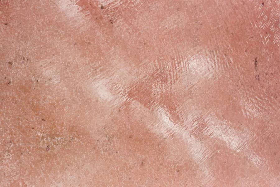 Kontaktni dermatitis: simptomi, uzroci i najbolje liječenje za osip i intenzivan svrab