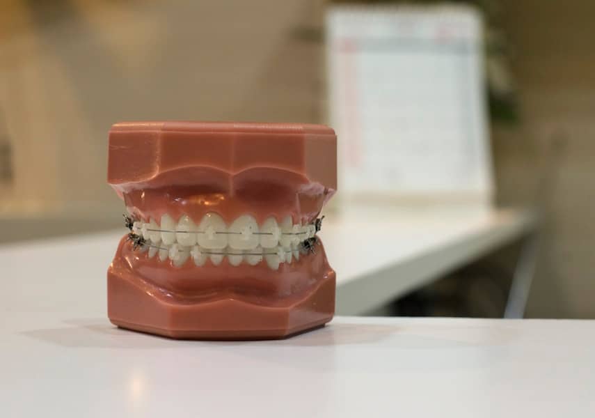 Kako prepoznati zdrave i nezdrave desni: simptomi gingivitisa, parodontitisa i najbolja prevencija