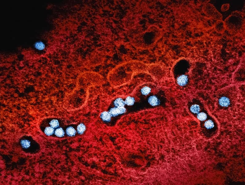 Groznica Zapadnog Nila u Srbiji: Najnoviji slučajevi, simptomi i mjere prevencije protiv komaraca