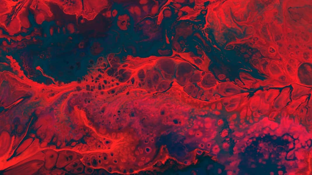 Eritrocitoza otkrivena: Simptomi, uzroci i lečenje koje sprečava opasne krvne ugruške (hematokrit, hemoglobin)