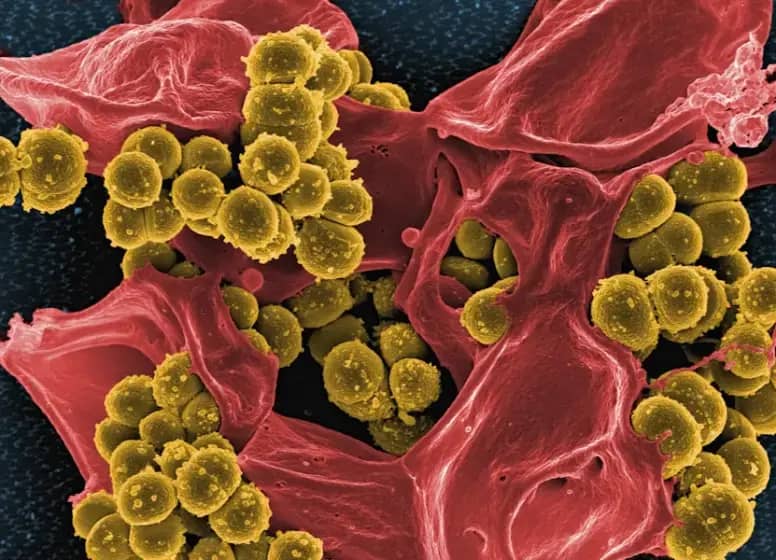 Propusno crevo i mikrobiom: Kako prepoznati simptome i prirodno izlečiti propusno crevo brzo