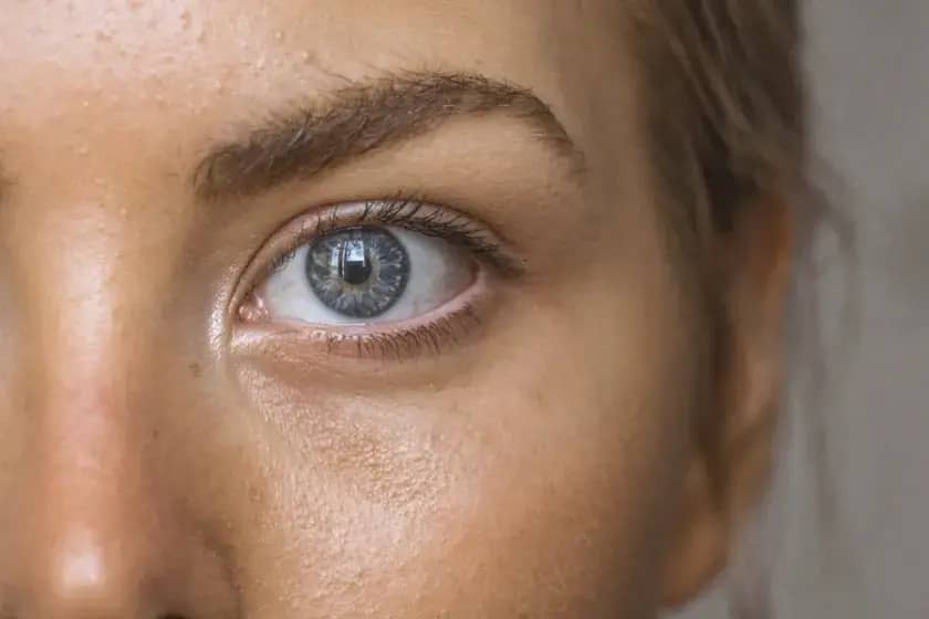 Suvo oko i degeneracija makule: simptomi, lečenje i kako izabrati najbolje veštačke suze