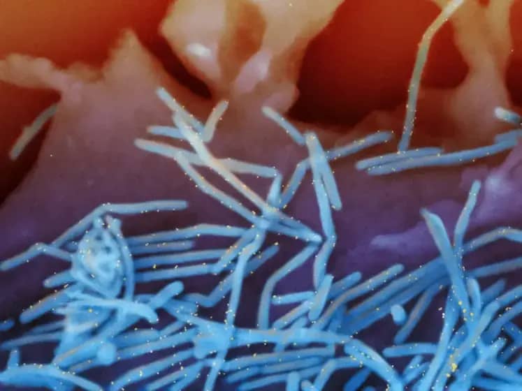CDC upozorenje: Simptomi, komplikacije i prevencija respiratornih virusnih infekcija koje morate znati